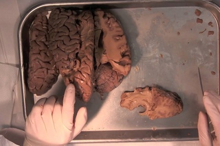 MIT Neuroanatomy: Part 4