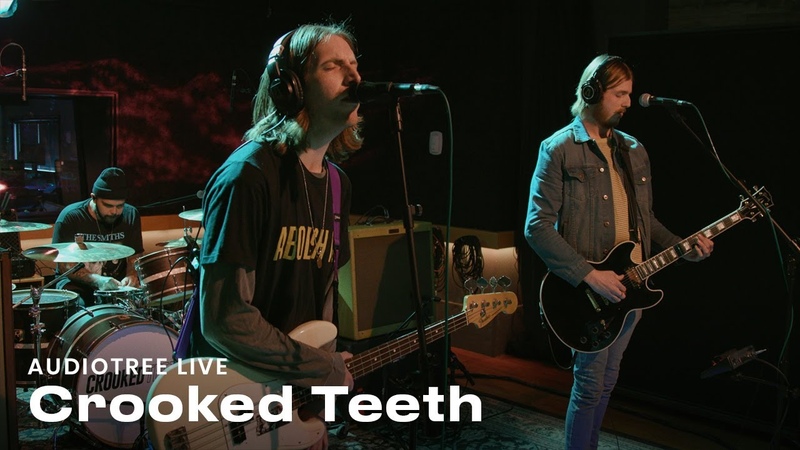 Crooked Teeth on Audiotree Live ( Full