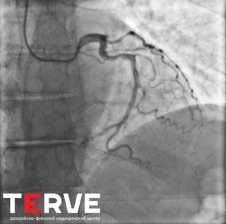 коронарография анатомия. коронарография краснодар.