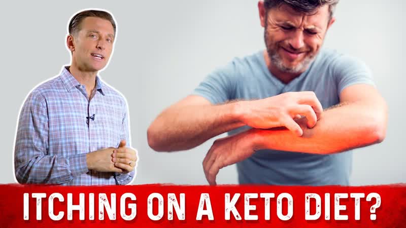 Are You Itching on a Ketogenic Diet Dr. Berg on Keto